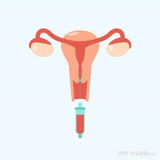 怀孕-患有多囊卵巢如何快速怀孕--哪种方法最好？